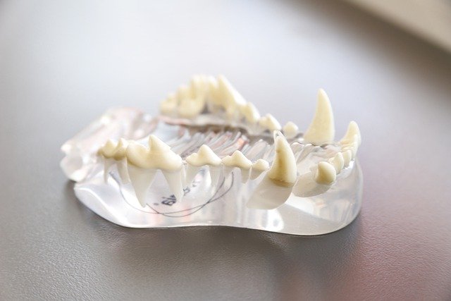 tooth-model-4904772_640